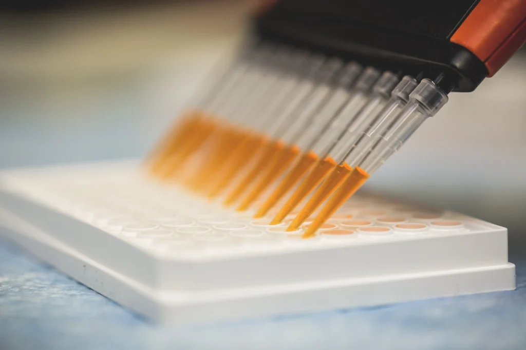 Dosage hormonal en laboratoire illustrant l’impact de la SHBG sur la testostérone libre et biodisponible.